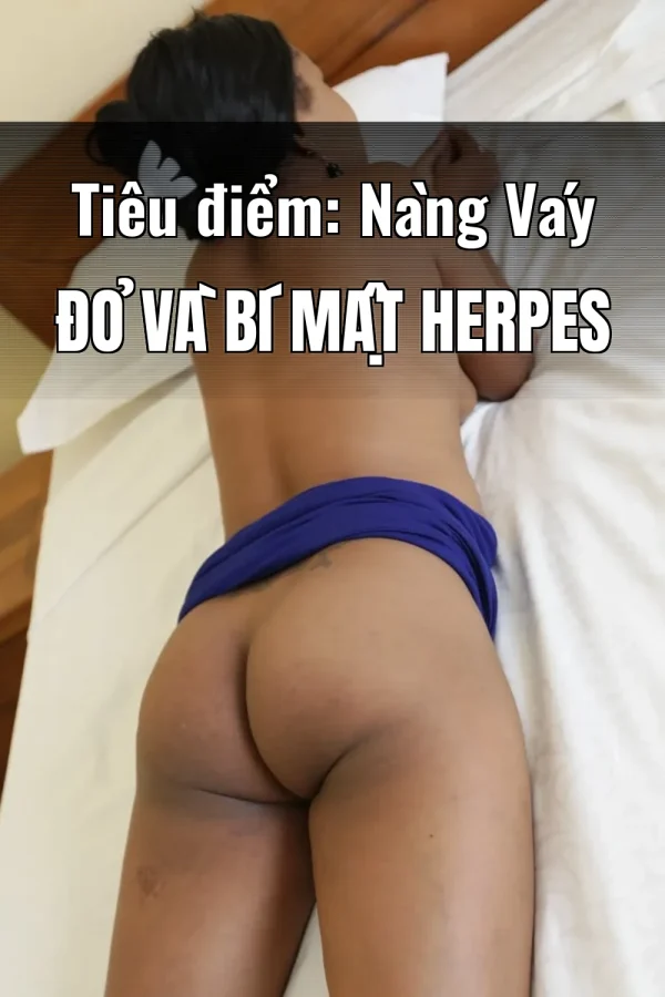 Tiêu điểm: Nàng Váy Đỏ Và Bí Mật Herpes